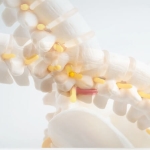 Bacaklarda Uyuşma ve Yürüme Güçlüğü: Dar Kanal Hastalığına Dikkat!