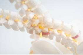 Bacaklarda Uyuşma ve Yürüme Güçlüğü: Dar Kanal Hastalığına Dikkat!