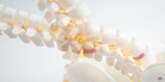 Bacaklarda Uyuşma ve Yürüme Güçlüğü: Dar Kanal Hastalığına Dikkat!