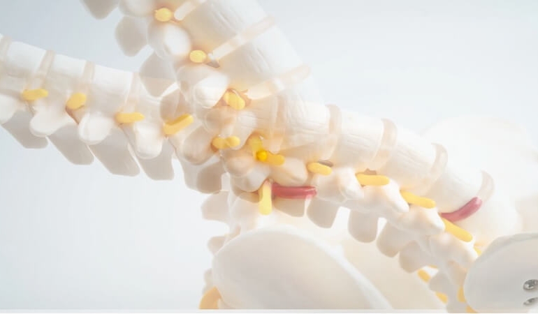 Bacaklarda Uyuşma ve Yürüme Güçlüğü: Dar Kanal Hastalığına Dikkat!