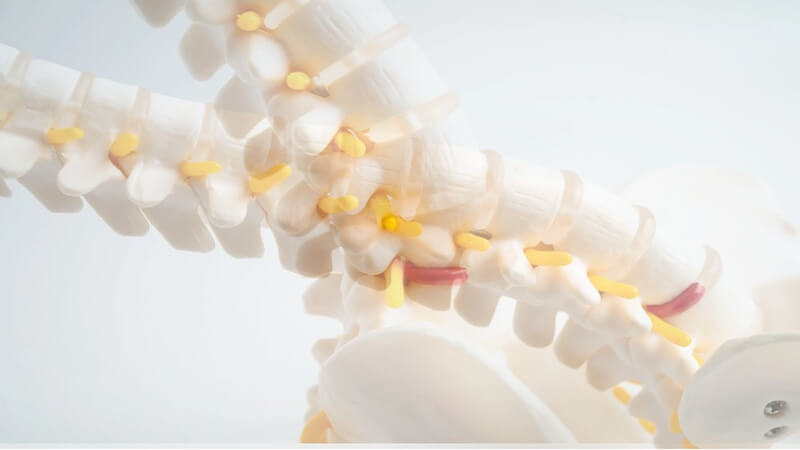 Bacaklarda Uyuşma ve Yürüme Güçlüğü: Dar Kanal Hastalığına Dikkat!